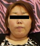 らん(B: 88 W: 72 H: 87)